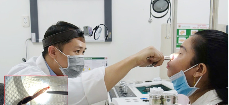 Đồng Nai: Gắp con vắt dài 8cm trong mũi nữ bệnh nhân ở Biên Hòa