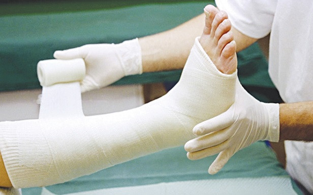Bó bột và các vấn đề thường gặp