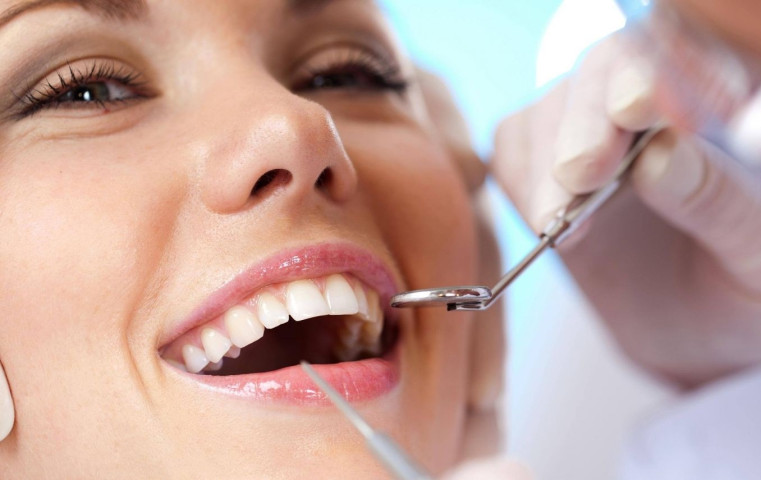 Lấy cao răng định kỳ: Bí quyết giữ gìn sức khỏe răng miệng