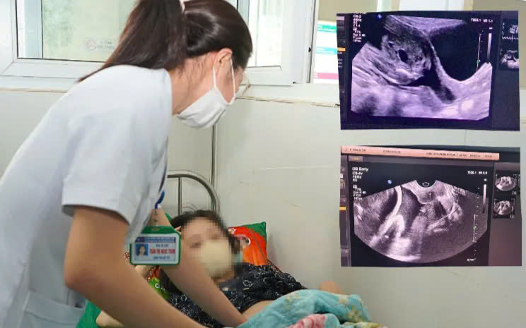 Nghệ An: Khâu eo cổ tử cung giúp giữ thai 22 tuần cho sản phụ