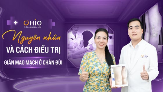 Nguyên nhân gây giãn mao mạch ở chân đùi