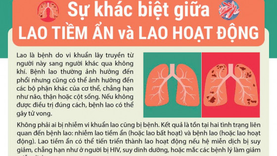 Sự khác biệt giữa lao tiềm ẩn và lao hoạt động