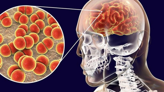 Yên Bái: Ghi nhận một trường hợp dương tính với vi khuẩn não mô cầu
