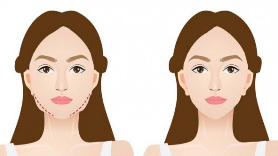 8 mẹo hiệu quả để giảm mỡ mặt