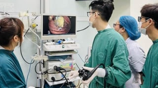 Hà Nội: Cụ bà 65 tuổi được nội soi lấy bã thức ăn ra khỏi dạ dày