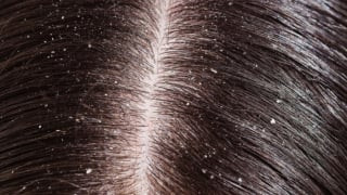 5 tín hiệu cho thấy tóc bạn đang “lên tiếng kêu cứu”