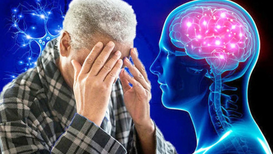 Tuổi thọ trung bình của người mắc Alzheimer là bao lâu?