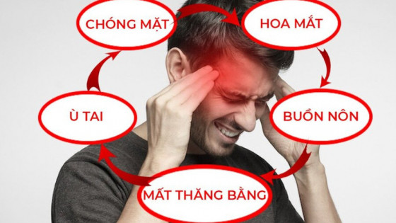 Rối loạn tiền đình: Dấu hiệu sớm và cách tự điều trị tại nhà