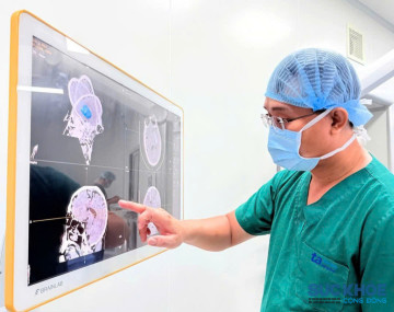 TP. Hồ Chí Minh: Kịp thời cứu sống bệnh nhân túi phình mạch não có kích thước 0,6 cm