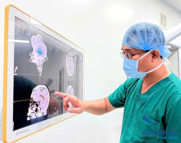 TP. Hồ Chí Minh: Kịp thời cứu sống bệnh nhân túi phình mạch não có kích thước 0,6 cm