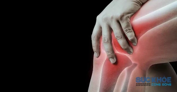 10 thói quen nhỏ mỗi ngày giúp xương vững chắc, ngừa loãng xương
