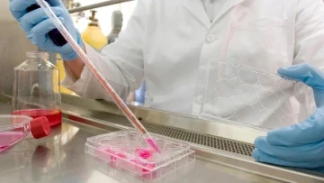 Bộ Y tế siết chặt kiểm soát "tế bào gốc xách tay", xây dựng tiêu chuẩn quốc gia mới