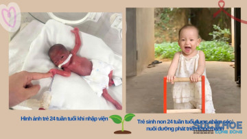 Bệnh viện Sản Nhi tỉnh Phú Thọ: Đột phá trong điều trị, nuôi dưỡng, chăm sóc và theo dõi trẻ sơ sinh nhẹ cân, non tháng