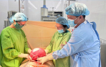 Cắt bỏ khối u xơ khổng lồ 4,5 kg, nữ bệnh nhân lấy lại sự nhẹ nhàng sau 10 năm chịu đựng