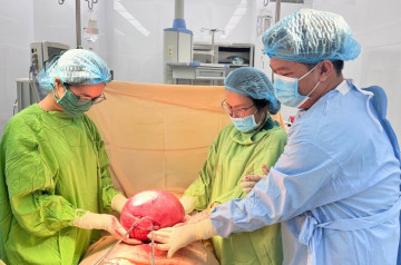 Cắt bỏ khối u xơ tử cung nặng 4,5kg cho người phụ nữ ở Cà Mau