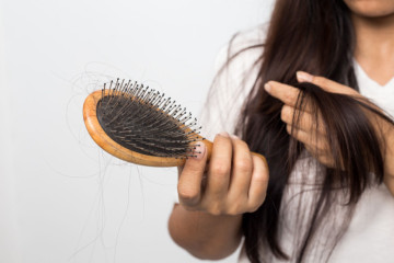 Bị rụng tóc tuổi dậy thì có sao không?