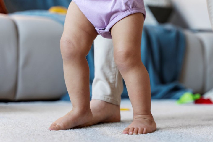 Tình trạng bẹt chân không di truyền: Dấu hiệu của bệnh lý xương khớp?