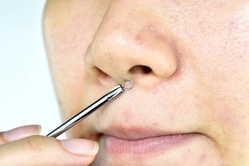 Vì sao không nên lạm dụng dụng cụ nặn mụn?