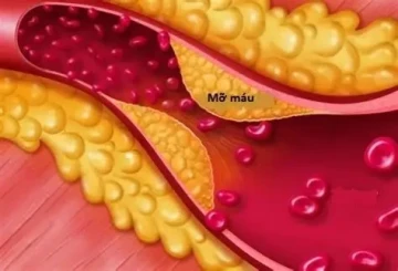 Chế độ ăn lành mạnh giúp kiểm soát mỡ máu