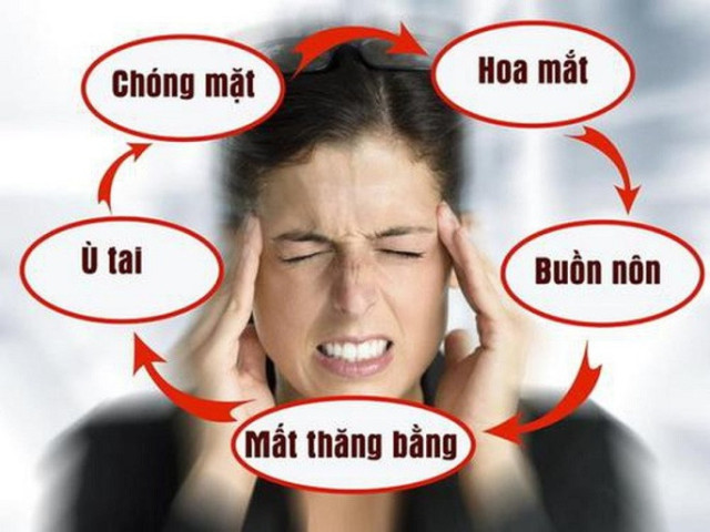 Rối loạn tiền đình: Những điều cần biết và cách phòng tránh