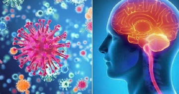 Nguy cơ cao từ bệnh não mô cầu xâm lấn: Hiếm gặp nhưng hiểm họa lớn