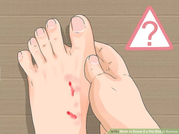 Cảnh báo: Cấp cứu sai cách khi bị chó, mèo cắn có thể gây nguy hiểm tính mạng
