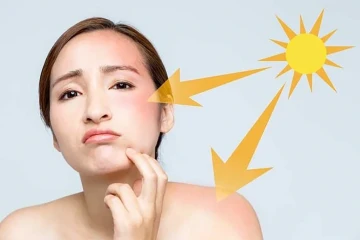 Chữa da rám nắng hiệu quả bằng vỏ cam