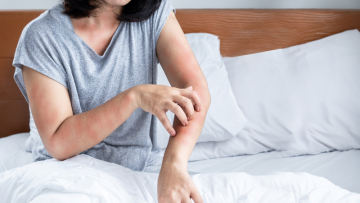 Sốt phát ban ở người lớn có lây không?