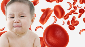Tại sao trẻ sơ sinh cũng mắc bệnh thiếu máu?