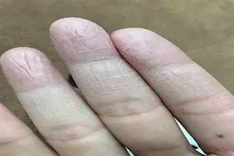 Cách giúp da tay căng bóng suốt mùa đông