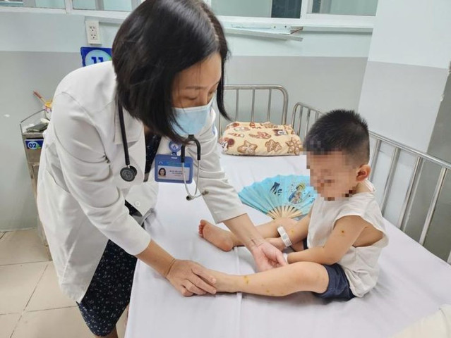 TP. Hồ Chí Minh: Bệnh tay chân miệng tăng  hơn 1.500 ca chỉ trong một tuần