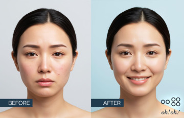 Khám phá Niacinamide: Thành phần được giới chuyên gia da liễu tin dùng
