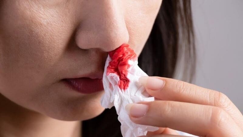 Nên xử lý thế nào khi bị chảy máu cam?