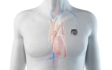 Hội chứng Kearns-Sayre: Căn bệnh hiếm gặp nhưng không thể chủ quan