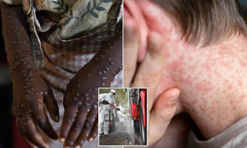 Ở ngưỡng cửa đại dịch? Những virus khiến giới khoa học lo ngại trong năm 2026