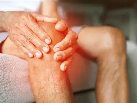 Hiểu đúng về chứng tràn dịch khớp