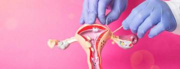 Triệt sản nữ có ảnh hưởng gì đến sức khỏe phụ nữ?