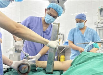 Người phụ nữ đến cấp cứu với bàn tay kẹt trong máy xay thịt