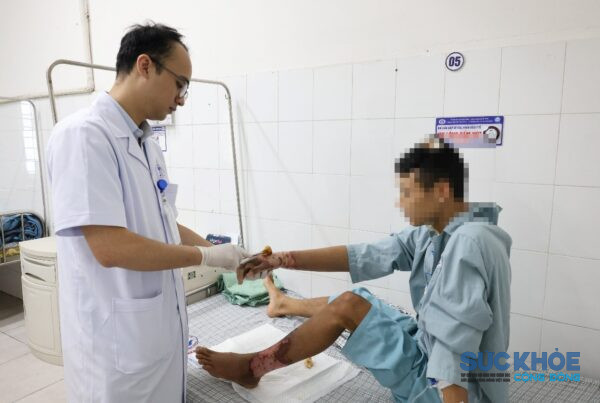 Câu cá bị điện giật: Lời cảnh tỉnh cho “cần thủ”