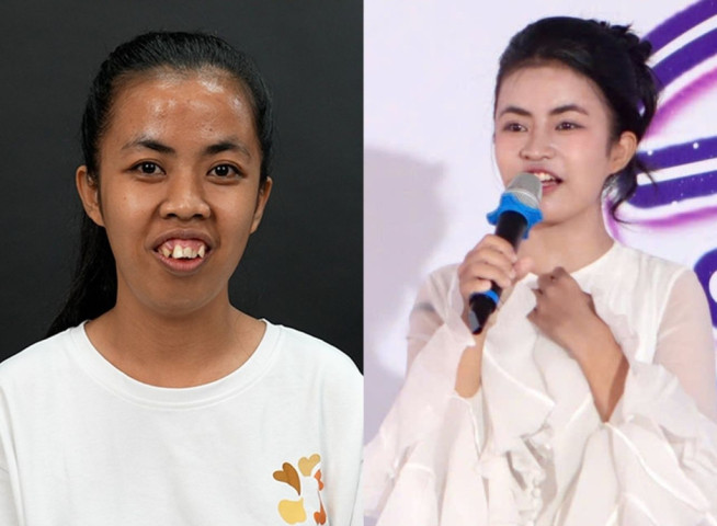 “Hành trình Lột xác”: Thay đổi ngoại hình, viết lại tương lai