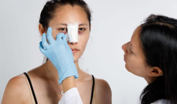 Nâng mũi nên ăn gì, kiêng gì để nhanh lành?