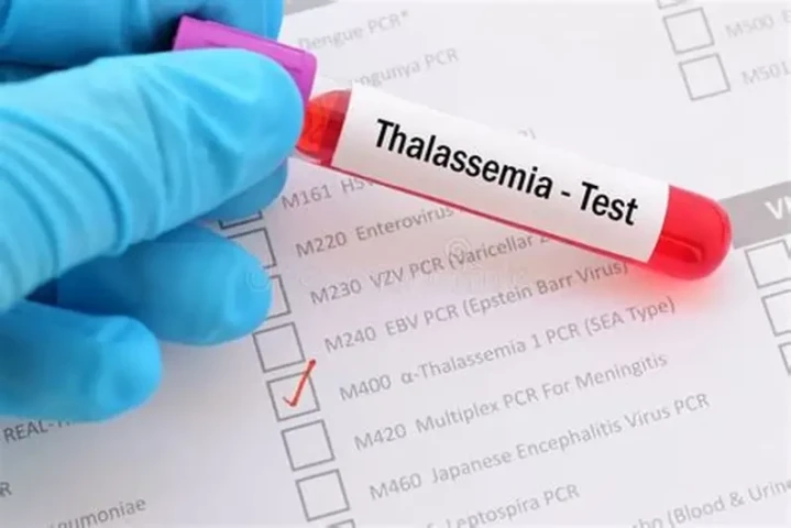Không phải cứ thiếu máu là bổ sung sắt: Hiểu lầm nguy hiểm với người mắc  bệnh Thalassemia