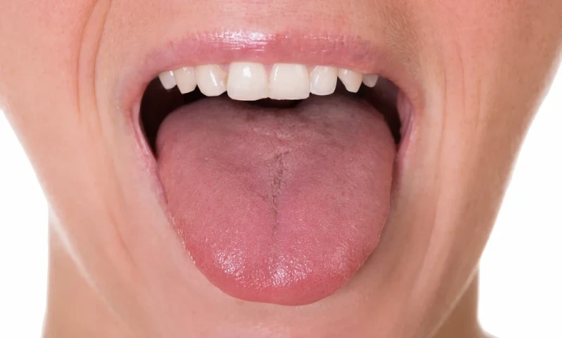 Rát lưỡi là dấu hiệu của bệnh gì?