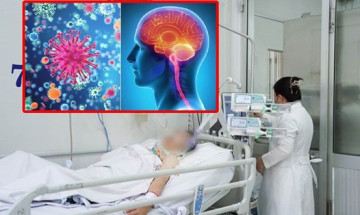 Dễ nhầm cảm cúm, cảnh báo não mô cầu đang tăng nhanh