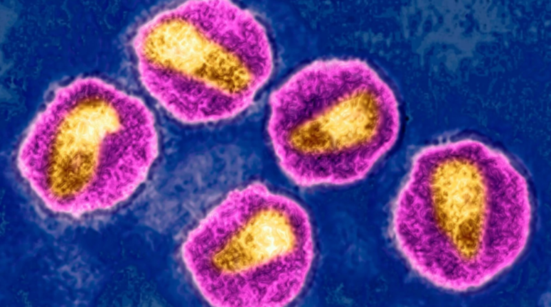 Lần đầu ghi nhận ca khỏi HIV sau ghép tế bào gốc từ người thân