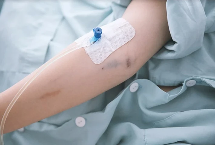 Cảnh báo nguy cơ nhiễm khuẩn huyết từ thói quen tự ý tiêm truyền tại nhà