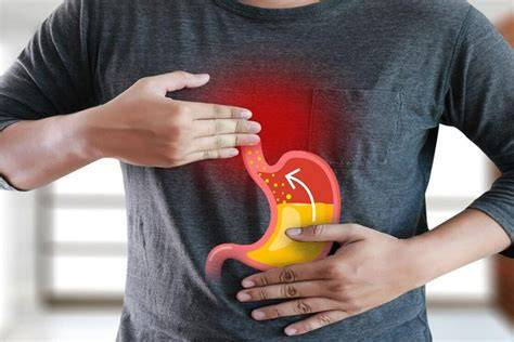 Mẹo khắc phục nhanh chứng trào ngược dạ dày