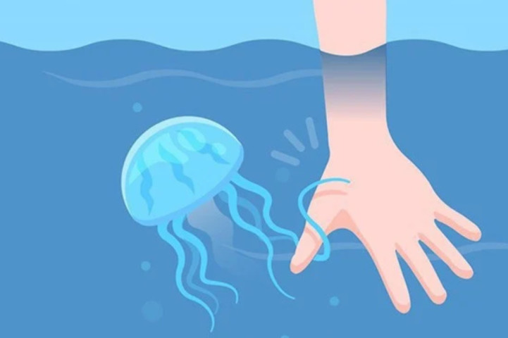 Cách xử lý khi bị sứa cắn khi đi biển