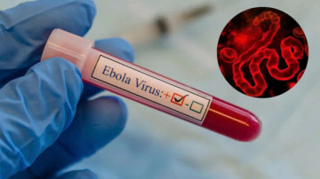 Tăng cường giám sát cửa khẩu, chủ động chặn nguy cơ Ebola xâm nhập