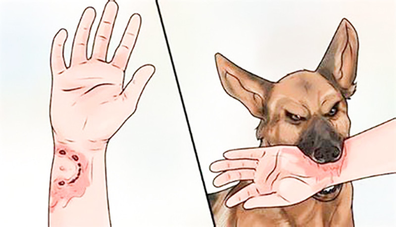 Bệnh dại nguy hiểm thế nào mà gần như 100% tử vong?